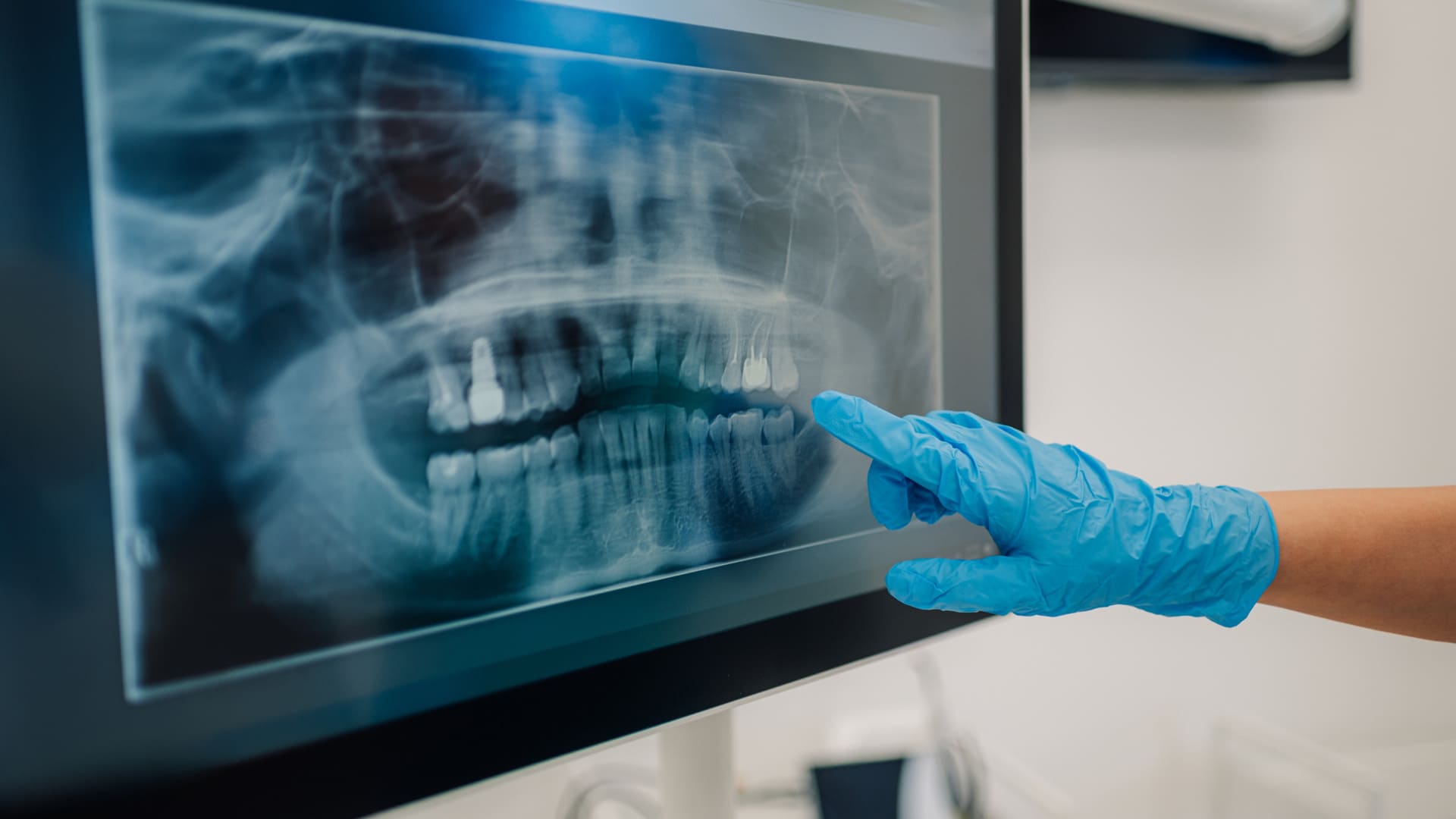 Radiologia Dentale