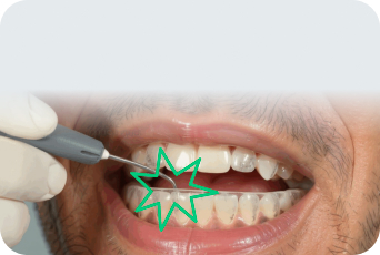 Injection Technique
