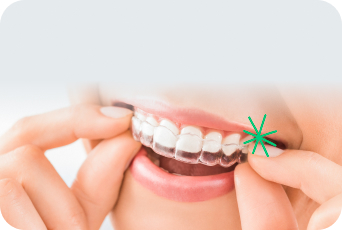 Invisalign